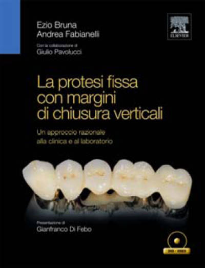 La protesi fissa con chiusura verticali